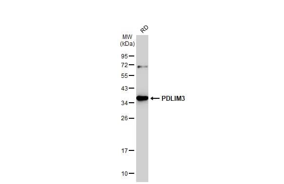 Western Blot: PDLIM3 Antibody [NBP2-19757] - Whole cell extract (30 ug) was separated by 12% SDS-PAGE, and the membrane was blotted with PDLIM3 antibody [C2C3], C-term (NBP2-19757) diluted at 1:500. The HRP-conjugated anti-rabbit IgG antibody  was used to detect the primary antibody.