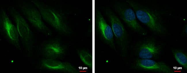 PDLIM4 antibody [C2C3], C-term detects PDLIM4 protein at cytoplasm by immunofluorescent analysis.Sample: HeLa cells were fixed in 4% paraformaldehyde at RT for 15 min.Green: PDLIM4 protein stained by PDLIM4 antibody [C2C3], C-term (NBP2-19759) diluted at 1:1000.Blue: Hoechst 33342 staining.Scale bar = 10 um. 