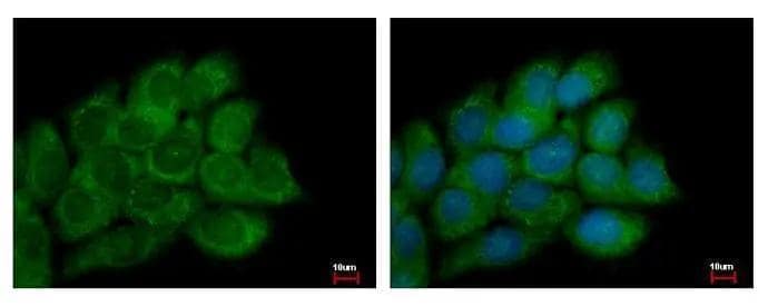 PECI antibody detects PECI protein at Mitochondria by immunofluorescent analysis. Sample: A431 cells were fixed in 2% paraformaldehyde/culture medium at 37C for 30 min.Green: PECI protein stained by PECI antibody (NBP2-19766) diluted at 1:500.Blue: Hoechst 33343 staining. 