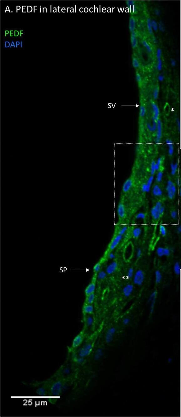 PEDF in the lateral cochlear wall. PEDF protein localization in the lateral cochlear wall. Stria vascularis (SV); Spiral prominence (SP); Marginal cell (MC); Basal cell (BC); type I fibrocytes (*); type II fibrocytes (**). (A) PEDF was localized to the spiral ligament, the stria vascularis and the spiral prominence. In the spiral ligament were type I and II fibrocytes PEDF positive. (B) Inset of higher magnification of marked area in (A). The distribution of PEDF in sub-cellular level of stria vascularis and spiral ligament. (C) Negative control of the immunohistochemistry. Image collected and cropped by CiteAb from the following open publication (//pubmed.ncbi.nlm.nih.gov/35392272), licensed under a CC-BY license. Not internally tested by Novus Biologicals.