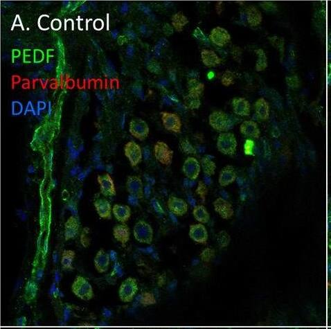 PEDF in the spiral ganglion following furosemide injection. (A–F) PEDF protein staining of guinea pig spiral ganglion following IV furosemide injection. (A) In the control was PEDF localized in the cytoplasm of the spiral ganglion type I neurons. (B–E) The staining intensity after furosemide at the different intervals. (F) Negative control. Image collected and cropped by CiteAb from the following open publication (//pubmed.ncbi.nlm.nih.gov/35392272), licensed under a CC-BY license. Not internally tested by Novus Biologicals.