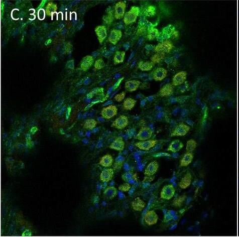 PEDF in the spiral ganglion following furosemide injection. (A–F) PEDF protein staining of guinea pig spiral ganglion following IV furosemide injection. (A) In the control was PEDF localized in the cytoplasm of the spiral ganglion type I neurons. (B–E) The staining intensity after furosemide at the different intervals. (F) Negative control. Image collected and cropped by CiteAb from the following open publication (//pubmed.ncbi.nlm.nih.gov/35392272), licensed under a CC-BY license. Not internally tested by Novus Biologicals.