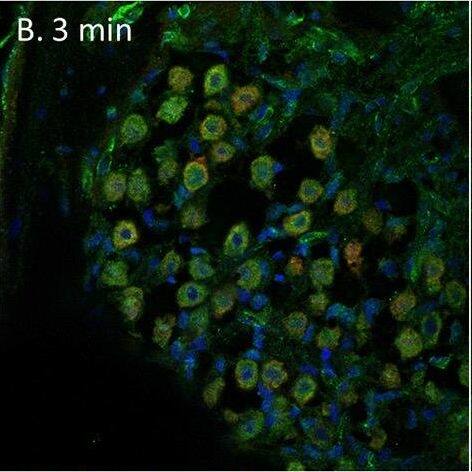 PEDF in the spiral ganglion following furosemide injection. (A–F) PEDF protein staining of guinea pig spiral ganglion following IV furosemide injection. (A) In the control was PEDF localized in the cytoplasm of the spiral ganglion type I neurons. (B–E) The staining intensity after furosemide at the different intervals. (F) Negative control. Image collected and cropped by CiteAb from the following open publication (//pubmed.ncbi.nlm.nih.gov/35392272), licensed under a CC-BY license. Not internally tested by Novus Biologicals.