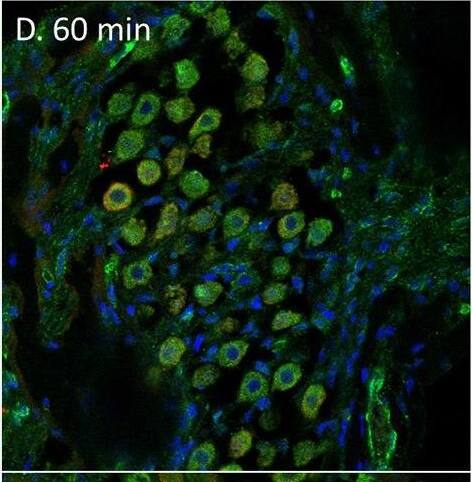 PEDF in the spiral ganglion following furosemide injection. (A–F) PEDF protein staining of guinea pig spiral ganglion following IV furosemide injection. (A) In the control was PEDF localized in the cytoplasm of the spiral ganglion type I neurons. (B–E) The staining intensity after furosemide at the different intervals. (F) Negative control. Image collected and cropped by CiteAb from the following open publication (//pubmed.ncbi.nlm.nih.gov/35392272), licensed under a CC-BY license. Not internally tested by Novus Biologicals.