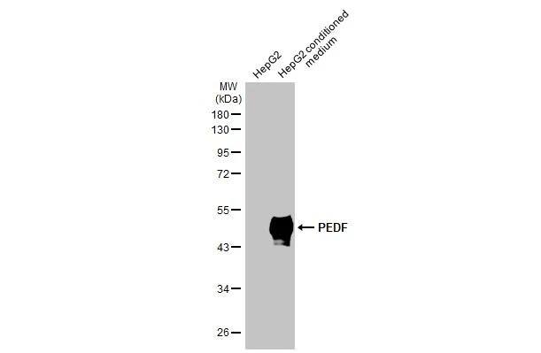 HepG2 whole cell extract and conditioned medium (30 ug) were separated by 10% SDS-PAGE, and the membrane was blotted with PEDF antibody [N1C2] (NBP2-19767) diluted at 1:2000. The HRP-conjugated anti-rabbit IgG antibody  was used to detect the primary antibody. 