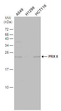 Various whole cell extracts (30 ug) were separated by 15% SDS-PAGE, and the membrane was blotted with PRX II antibody (NBP2-19776) diluted at 1:5000. The HRP-conjugated anti-rabbit IgG antibody  was used to detect the primary antibody. 