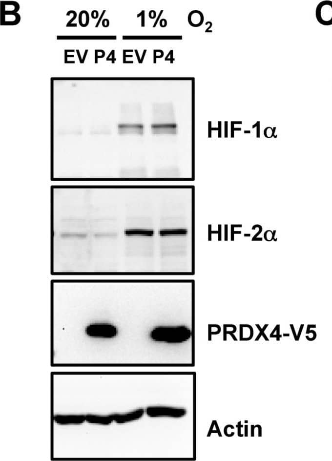 Western Blot: Peroxiredoxin 4 Antibody [NBP2-19778] - Expression of PRDX2 or PRDX4 does not affect HIF-1 alpha  or HIF-2 alpha  protein levelsA. & B. HeLa cells were transfected with EV or vector encoding PRDX2-V5 (A, P2) or PRDX4-V5 (B, P4), & exposed to 20% or 1% O2 for 24 h. WCL was subject to immunoblot assays with antibody against HIF-1 alpha , HIF-2 alpha , V5, or acin. C. HeLa-shSC (sc) & HeLa-shPRDX(2+4) (2+4) cells were exposed to 20% or 1% O2 for 24 h in the presence of doxycycline. WCL was subject to immunoblot assays with antibodies against HIF-1 alpha , HIF-2 alpha , PRDX2, PRDX4, & actin. Image collected & cropped by CiteAb from the following publication (//www.oncotarget.com/lookup/doi/10.18632/oncotarget.7142), licensed under a CC-BY license. Not internally tested by Novus Biologicals.