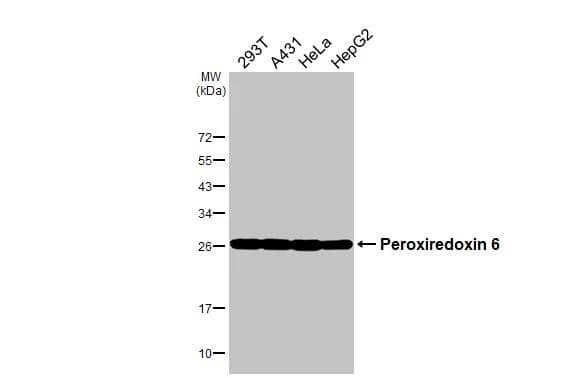Various whole cell extracts (30 ug) were separated by 12% SDS-PAGE, and the membrane was blotted with Peroxiredoxin 6 antibody (NBP2-19779) diluted at 1:1000. The HRP-conjugated anti-rabbit IgG antibody  was used to detect the primary antibody. 