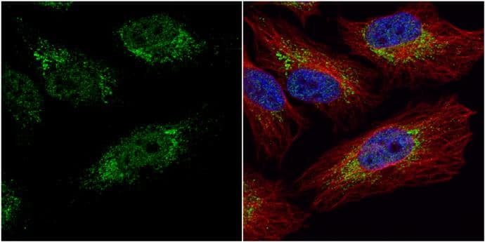 Immunocytochemistry/ Immunofluorescence PGK1 Antibody - BSA Free