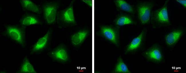 PGLS antibody detects PGLS protein at cytoplasm by immunofluorescent analysis.Sample: HeLa cells were fixed in 4% paraformaldehyde at RT for 15 min.Green: PGLS protein stained by PGLS antibody (NBP2-19785) diluted at 1:500.Blue: Hoechst 33342 staining.Scale bar = 10 um. 