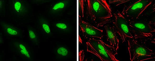 PHF10 antibody detects PHF10 protein at nucleus by immunofluorescent analysis.Sample: HeLa cells were fixed in 4% paraformaldehyde at RT for 15 min.Green: PHF10 protein stained by PHF10 antibody (NBP2-19795) diluted at 1:500.Red: Phalloidin, a cytoskeleton marker, diluted at 1:100.Blue: Hoechst 33342 staining. 