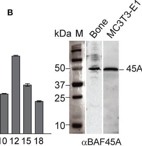 Baf45a expression levels induce gene expression profiles for osteoblast differentiation. (A) Relative expression levels of Baf45a (left panel) and Runx2 (right panel) were obtained by real-time RT-qPCR using DNase I treated total RNA isolated from murine preosteoblast MC3T3-E1 cells induced to differentiate for 18 days. Gapdh mRNA profile was used as an experimental control. (B) Representative Western blot analysis with anti-BAF45A antibody of lysates from the femur and MC3T3-E1 cells. Molecular weight markers were indicated in kDa. (C) Relative protein levels of BAF45A (upper panel) and RUNX2 (middle panel) were obtained by Western blot analysis using total cell lysate isolated from murine calvarial osteoblast cells induced to differentiate for 25 days. Beta Tubulin protein profile (lower panel) was used as loading control. (D) Relative expression levels of Runx2 were obtained by real-time RT-qPCR using DNase I treated total RNA isolated from murine calvarial cells induced to differentiate for 25 days. (E) Overexpression of Baf45a in MC3T3-E1 osteoblast cells normalized to Gapdh after 72 hours by RT-qPCR. (F–J) Expressions of Runx2, Sp7 (osterix) osterix, Hoxa5, Hoxa10, and Hoxa11 were assessed by RT-qPCR and normalized to Gapdh. (J) Early markers Alp and Col1A1 and (K) late markers Spp1(Opn), and Ocn were assayed. Statistical significance was determined by Student’s t-test (*P ≤ 0.05; **P ≤ 0.01; ***P ≤ 0.001 versus matched control). Gapdh expression was used as the control. Image collected and cropped by CiteAb from the following open publication (//pubmed.ncbi.nlm.nih.gov/35046892), licensed under a CC-BY license. Not internally tested by Novus Biologicals.