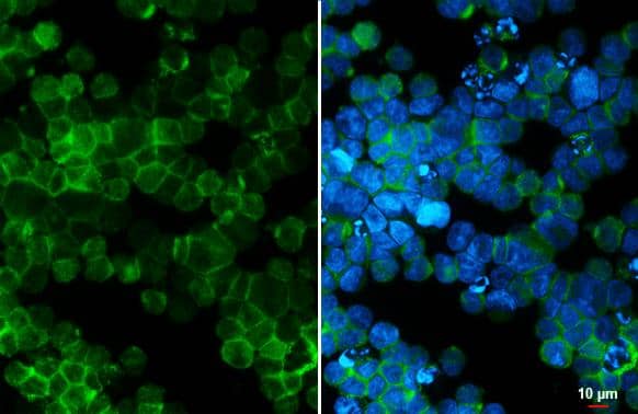 Immunocytochemistry/ Immunofluorescence PIK3CA Antibody - BSA Free
