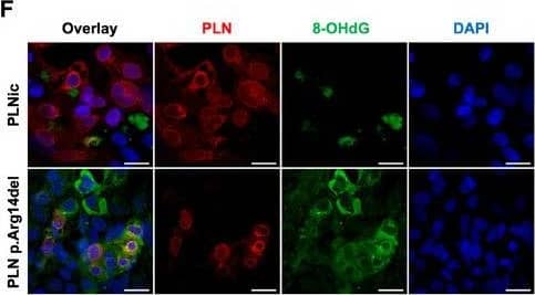 Immunocytochemistry/ Immunofluorescence Phospholamban Antibody - BSA Free