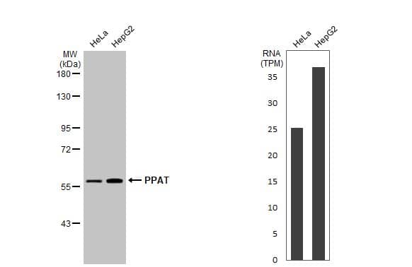 Various whole cell extracts (30 ug) were separated by 7.5% SDS-PAGE, and the membrane was blotted with PPAT antibody (NBP2-19812) diluted at 1:1000. The HRP-conjugated anti-rabbit IgG antibody  was used to detect the primary antibody, and the signal was developed with Trident ECL plus-Enhanced. Corresponding RNA expression data for the same cell lines are based on Human Protein Atlas program. 