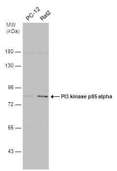 Various whole cell extracts (30 ug) were separated by 7.5% SDS-PAGE, and the membrane was blotted with PI3 kinase p85 alpha antibody [N2C1], Internal (NBP2-19815) diluted at 1:1000. The HRP-conjugated anti-rabbit IgG antibody  was used to detect the primary antibody. 