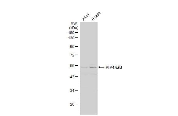Western Blot PIP5K2B Antibody - BSA Free