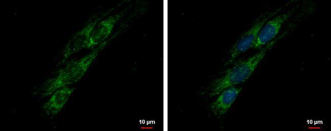PITRM1 antibody detects PITRM1 protein at mitochondria by immunofluorescent analysis.Sample: SKNSH cells were fixed in ice-cold MeOH for 5 min.Green: PITRM1 protein stained by PITRM1 antibody (NBP2-19844) diluted at 1:500.Blue: Hoechst 33342 staining.Scale bar = 10 um. 