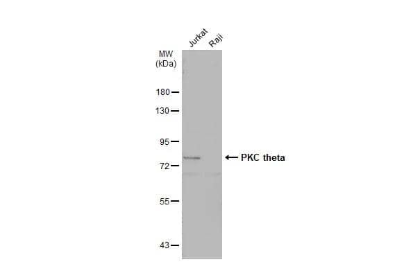 Various whole cell extracts (30 ug) were separated by 7.5% SDS-PAGE, and the membrane was blotted with PKC theta antibody [N1N3-2] (NBP2-19851) diluted at 1:500. The HRP-conjugated anti-rabbit IgG antibody  was used to detect the primary antibody. 