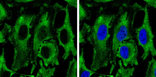 Immunocytochemistry/ Immunofluorescence: PKM2 Antibody [NBP2-19852] - PKM2 antibody detects PKM2 protein at cytoplasm by immunofluorescent analysis.Sample: HeLa cells were fixed in 4% paraformaldehyde at RT for 15 min.Green: PKM2 protein stained by PKM2 antibody (NBP2-19852) diluted at 1:500.Blue: Hoechst 33342 staining.