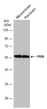 Western Blot: PKM2 Antibody [NBP2-19852] - Various tissue extracts (50 ug) were separated by 10% SDS-PAGE, and the membrane was blotted with PKM2 antibody (NBP2-19852) diluted at 1:5000.