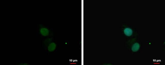 Immunocytochemistry/ Immunofluorescence PKNOX1 Antibody - BSA Free