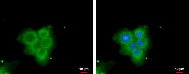 PLA2G4F antibody [N3C2], Internal detects PLA2G4F protein at cytoplasm by immunofluorescent analysis.Sample: A431 cells were fixed in 4% paraformaldehyde at RT for 15 min.Green: PLA2G4F protein stained by PLA2G4F antibody [N3C2], Internal (NBP2-19855) diluted at 1:500.Blue: Hoechst 33342 staining. 