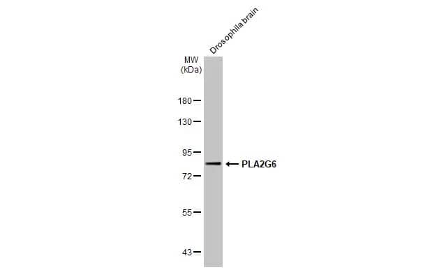 Western Blot: PLA2G6 Antibody [NBP2-19856] - Drosophila tissue extract (50 ug) was separated by 7.5% SDS-PAGE, and the membrane was blotted with PLA2G6 antibody [N3C3] (NBP2-19856) diluted at 1:500. The HRP-conjugated anti-rabbit IgG antibody  was used to detect the primary antibody.