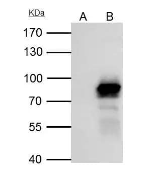 PLAP antibody [N3C2], Internal immunoprecipitates PLAP protein in IP experiments. IP Sample: NT2D1 whole cell lysate/extract A : Control with 3 ug of pre-immune rabbit IgG B : Immunoprecipitation of PLAP by 3 ug of PLAP antibody [N3C2], Internal (NBP2-19858) 7.5% SDS-PAGE The immunoprecipitated PLAP protein was detected by PLAP antibody [N3C2], Internal (NBP2-19858) diluted at 1 : 1000. EasyBlot anti-rabbit IgG (HRP)  was used as a secondary reagent. 