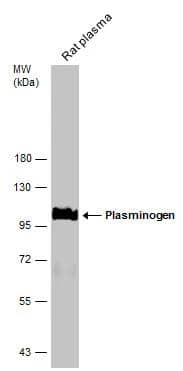 Western Blot Plasminogen Antibody