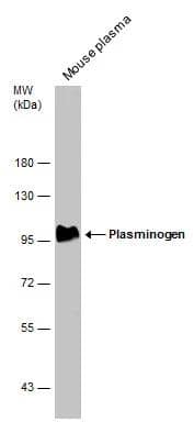 Western Blot Plasminogen Antibody