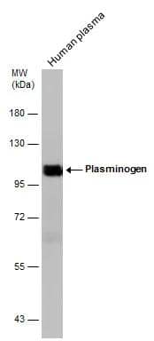 Western Blot Plasminogen Antibody