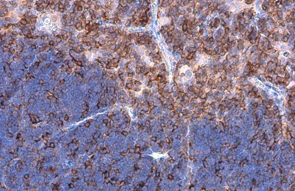 Immunohistochemistry-Paraffin: Plastin L Antibody [NBP2-19860] - Plastin L antibody detects Plastin L protein at cell membrane by immunohistochemical analysis.Sample: Paraffin-embedded mouse thymus gland.Plastin L stained by Plastin L antibody (NBP2-19860) diluted at 1:500.Antigen Retrieval: Citrate buffer, pH 6.0, 15 min