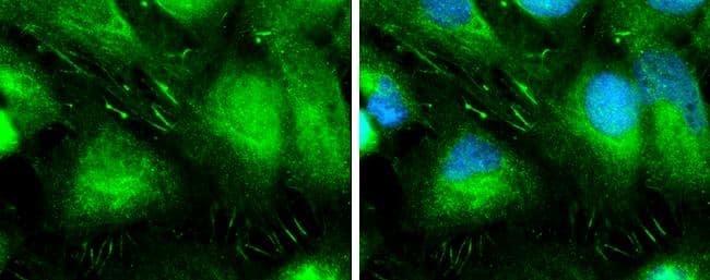 L-Plastin antibody detects L-Plastin protein at cytoplasm and focal adhesion site by immunofluorescent analysis.Sample: A431 cells were fixed in ice-cold MeOH for 5 min.Green: L-Plastin protein stained by L-Plastin antibody (NBP2-19860) diluted at 1:500.Blue: Hoechst 33342 staining. 
