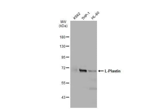 Various whole cell extracts (30 ug) were separated by 7.5% SDS-PAGE, and the membrane was blotted with L-Plastin antibody (NBP2-19860) diluted at 1:10000. The HRP-conjugated anti-rabbit IgG antibody  was used to detect the primary antibody. 