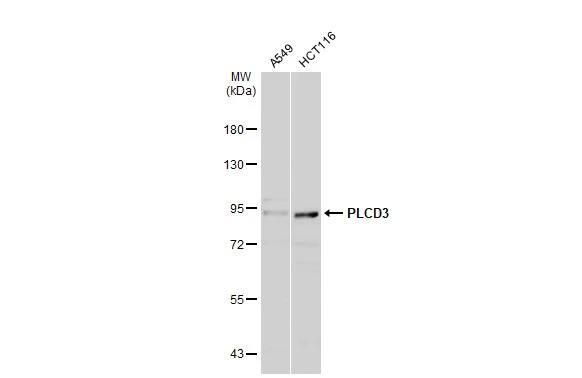 Western Blot: PLC-delta 3 Antibody [NBP2-19862] - Various whole cell extracts (30 ug) were separated by 7.5% SDS-PAGE, and the membrane was blotted with PLC-delta 3 antibody (NBP2-19862) diluted at 1:500. The HRP-conjugated anti-rabbit IgG antibody  was used to detect the primary antibody.