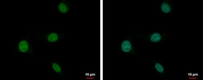 PLZF antibody [N1N3] detects PLZF protein at nucleus by immunofluorescent analysis.Sample: U87-MG cells were fixed in 4% paraformaldehyde at RT for 15 min.Green: PLZF protein stained by PLZF antibody [N1N3] (NBP2-19870) diluted at 1:2000.Blue: Hoechst 33342 staining. 