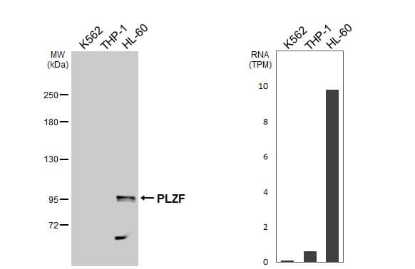 Various whole cell extracts (30 ug) were separated by 5% SDS-PAGE, and the membrane was blotted with PLZF antibody [N1N3] (NBP2-19870) diluted at 1:2000. The HRP-conjugated anti-rabbit IgG antibody  was used to detect the primary antibody. Corresponding RNA expression data are based on Human Protein Atlas program. 