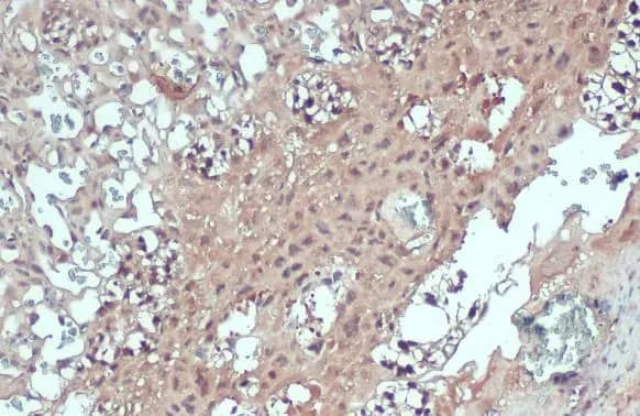 Immunohistochemistry-Paraffin: PNMT Antibody [NBP2-19877] - PNMT antibody [N2C3] detects PNMT protein at cytoplasm by immunohistochemical analysis.Sample: Paraffin-embedded mouse placenta.PNMT stained by PNMT antibody [N2C3] (NBP2-19877) diluted at 1:500.Antigen Retrieval: Citrate buffer, pH 6.0, 15 min