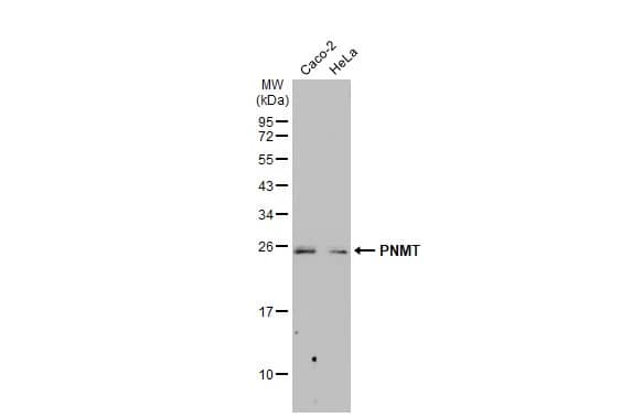 Western Blot: PNMT Antibody [NBP2-19877] - Various whole cell extracts (30 ug) were separated by 12% SDS-PAGE, and the membrane was blotted with PNMT antibody [N2C3] (NBP2-19877) diluted at 1:1000. The HRP-conjugated anti-rabbit IgG antibody  was used to detect the primary antibody.