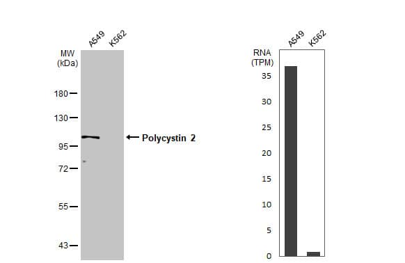 <b>Orthogonal Strategies Validation. </b>Western Blot: Polycystin 2 Antibody [NBP2-19889] - Various whole cell extracts (30 ug) were separated by 7.5% SDS-PAGE, and the membrane was blotted with Polycystin 2 antibody  diluted at 1:500. The HRP-conjugated anti-rabbit IgG antibody  was used to detect the primary antibody, and the signal was developed with Trident ECL plus-Enhanced. Corresponding RNA expression data for the same cell lines are based on Human Protein Atlas program.