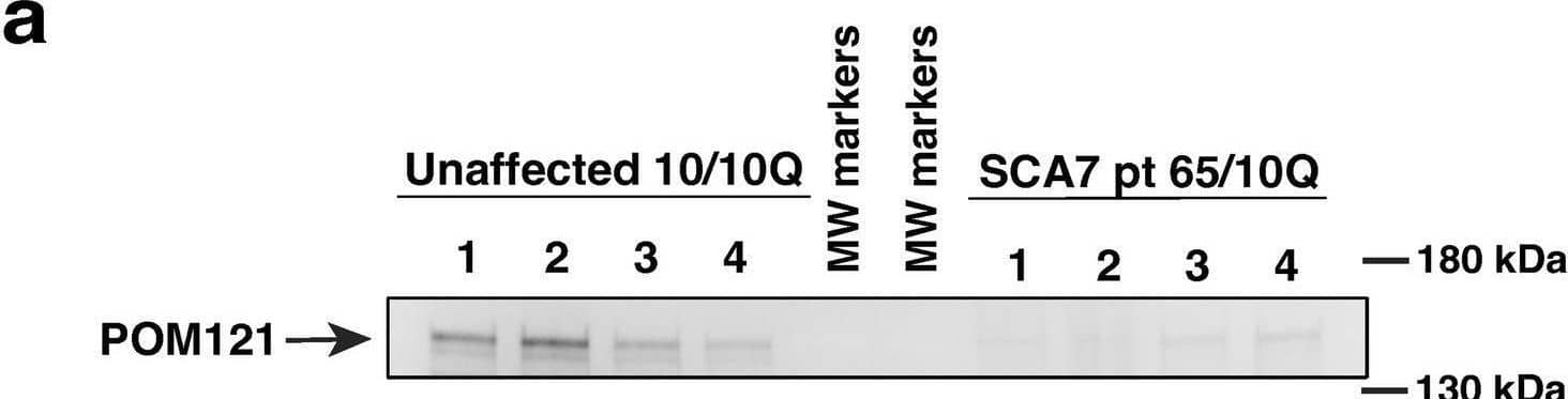 SCA7 patient NPCs display a marked reduction in the expression level of nucleoporin POM121. (a) We performed immunoblot analysis on neuron progenitor cells (NPCs) derived from either an unaffected related control (10Q/10Q) and on NPCs derived from a SCA7 patient (65Q/10Q) after obtaining protein lysates, and preparing and loading samples with identical amounts of total protein. Levels of full-length POM121 protein, which migrates at ~145 kDa, are visibly reduced in four SCA7 NPC biological replicates compared to four NPC biological replicates from the unaffected related control. (b) To assure equivalent loading and protein level normalization, we used a 4–20% Stain-Free TGX gel (shown here). (c) After quantifying POM121 protein levels by densitometry and normalizing to total protein using stain-free technology (BioRad), we noted a significant >40% reduction in POM121 protein expression in SCA7 NPCs. Data was normalized to unaffected control mean, which was arbitrarily set to 1.0, and then compared by nested t-test, p = 0.0286. Image collected and cropped by CiteAb from the following open publication (//pubmed.ncbi.nlm.nih.gov/39649105), licensed under a CC-BY license. Not internally tested by Novus Biologicals.
