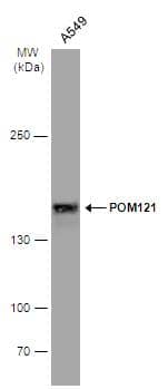 Whole cell extract (30 ug) was separated by 5% SDS-PAGE, and the membrane was blotted with POM121 antibody [N2N3] (NBP2-19890) diluted at 1:2000. The HRP-conjugated anti-rabbit IgG antibody  was used to detect the primary antibody. 
