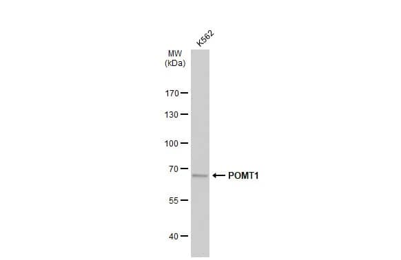 Western Blot: POMT1 Antibody [NBP2-19891] - Whole cell extract (30 ug) was separated by 7.5% SDS-PAGE, and the membrane was blotted with POMT1 antibody [C1C3] (NBP2-19891) diluted at 1:1000. The HRP-conjugated anti-rabbit IgG antibody  was used to detect the primary antibody.