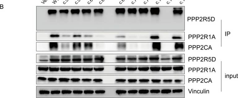 Protein expression levels of PPP2R5D and its interaction with the PPP2CA and PPP2R1A. (A) HA-tagged PPP2R5D WT/variants were transfected in 293T cells, protein expression was detected through Western blot. A 66 kDa band was detected in all missense variants. As for frameshift variant H436Mfs*3, a ~50 kDa band was detected and it was significantly weaker. (B) HA-tagged PPP2R5D WT/variants were purified through HA pull down, the interaction with endogenous PPP2CA and PPP2R1A were detected through Western blot. No band of PPP2CA and PPP2R1A was detected in W207R, D251H, D251Y and H463Mfs*3. A weaker band of PPP2CA and PPP2R1A was detected in E198K, E200K, L203P and Q211P. Image collected and cropped by CiteAb from the following open publication (//www.mdpi.com/2227-9067/11/8/897), licensed under a CC-BY license. Not internally tested by Novus Biologicals.