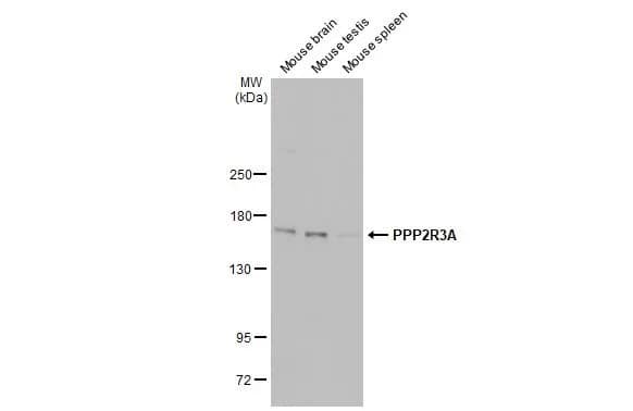 Western Blot: PPP2R3A Antibody [NBP2-19908] - Various tissue extracts (50 ug) were separated by 5% SDS-PAGE, and the membrane was blotted with PPP2R3A antibody [C2C3], C-term (NBP2-19908) diluted at 1:500. The HRP-conjugated anti-rabbit IgG antibody  was used to detect the primary antibody.