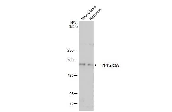 Western Blot: PPP2R3A Antibody [NBP2-19908] - Various tissue extracts (50 ug) were separated by 5% SDS-PAGE, and the membrane was blotted with PPP2R3A antibody [C2C3], C-term (NBP2-19908) diluted at 1:1000. The HRP-conjugated anti-rabbit IgG antibody  was used to detect the primary antibody, and the signal was developed with Trident ECL plus-Enhanced.