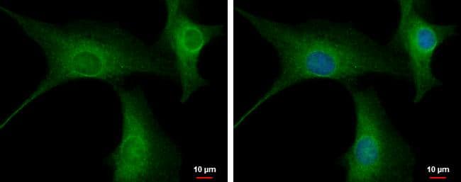 Immunocytochemistry/ Immunofluorescence PPP2R3A Antibody