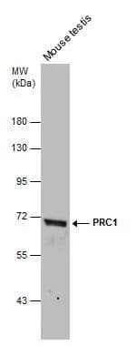 Mouse tissue extract (50 ug) was separated by 7.5% SDS-PAGE, and the membrane was blotted with PRC1 antibody [N1N2], N-term (NBP2-19925) diluted at 1:1000. 
