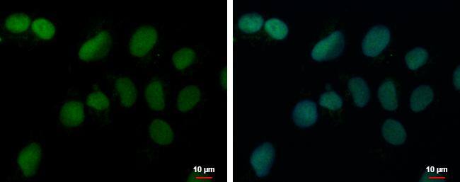 PRDM4 antibody detects PRDM4 protein at nucleus by immunofluorescent analysis.Sample: NT2D1 cells were fixed in 4% paraformaldehyde at RT for 15 min.Green: PRDM4 protein stained by PRDM4 antibody (NBP2-19926) diluted at 1:500.Blue: Hoechst 33342 staining.Scale bar = 10 um. 
